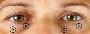 5 Tips to Prevent Dark Eye Circles  