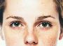 The Future of Pigmentation Treatment in Singapore
