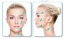 Don't Make These Skin Rejuvenation Treatments Mistakes