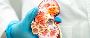 Kidney Transplant Surgery | Maddadgar Foundation