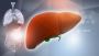 Liver Replacement Surgery | Maddadgar Foundation