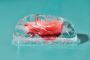Heart Transplant Surgery | Maddadgar Foundation