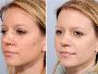 Best Dermatologists for Skin Tag Removal Mumbai