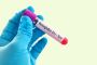 Glycosylated Haemoglobin Test