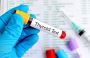 Thyroid Profile Test