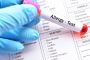 Allergy Profile Test
