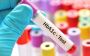 HbA1C Blood Test