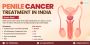 Penile Cancer Treatment In India: Costs And Hospitals