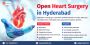 Open Heart Surgery Cost in Hyderabad 
