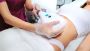 Coolsculpting