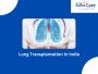 Lung Transplantation In India Lung Transplantation In India