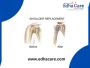 Shoulder Replacement Surgery In India | EdhaCare