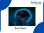 Best Brain Tumor Surgery In India | EdhaCare
