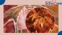 Tuberculosis Treatment In India | EdhaCare