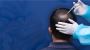 Expert Hair Loss & Baldness Treatment at Kosmoderma