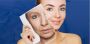 Laser & Fractional Skin Rejuvenation Treatment in Santacruz 