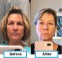 This secret antioxidant women use to keep youthful!