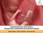 How to Prepare When a Baby Has a Belly Issue Before Birth