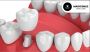 Simple Habits That Help Your Dental Crowns Last Longer