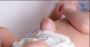 What Parents Should Know about Umbilical Hernia in Infants