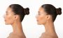 Who is the Best Rhinoplasty Surgeon in India?