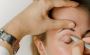 Tired Eyes? Here’s the Best Fix for Sagging Skin - Dr. Lokes
