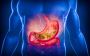 Accurate Gastro Infection Lab Testing – Quick & Reliable Res