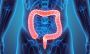 Best Colorectal Surgery in Dubai–Effective & Safe Procedures