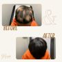 Naturally restore your hair’s volume and strength
