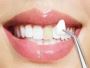  Transform Your Smile with Dental Veneers - Mesa Dental