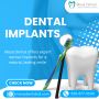 Achieve a Perfect Smile with Dental Implants at Mesa Dental