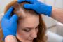 Scalp Micropigmentation: Regain Confidence With Our Service