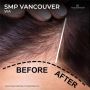 SMP near Vancouver: Get An Enhanced Natural Look of Your Sca