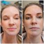 Digital Microblading: Get Fuller, Natural Brows
