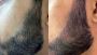 Beard Tattoo Solutions at Elite Institute of Micropigmentati