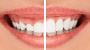 TOP DENTIST IN GURGAON - MOS