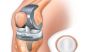  Effective Knee Pain Treatment in Lahore - Ortho Center Paki
