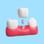 Enjoy Expert Dental Implant Services in Kolkata