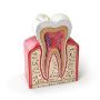 Get the Best Root Canal Treatment in Kolkata. Mission Smile