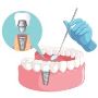 Safe & Reliable Dental Implant Kolkata for Single/Multiple