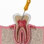 Expert Root Canal Treatment in Kolkata for Lasting Relief