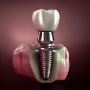 Expert Dental Implant Services in Kolkata for Lasting Smiles