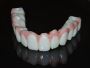 Reliable Zirconia Blanks Manufacturing Company in the USA