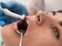 How to Choose the Right Dentist for Root Canal Treatments in