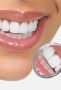 Safe Wisdom Teeth Removal in Morayfield