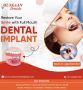 Full Mouth Dental Implants in India