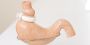 Looking for a Bariatric Surgery in Ahmedabad