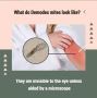 What do Demodex mites look like?