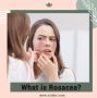 What is Rosacea? 🤔