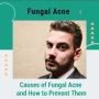 Causes of Fungal Acne and How to Prevent Them 🤔